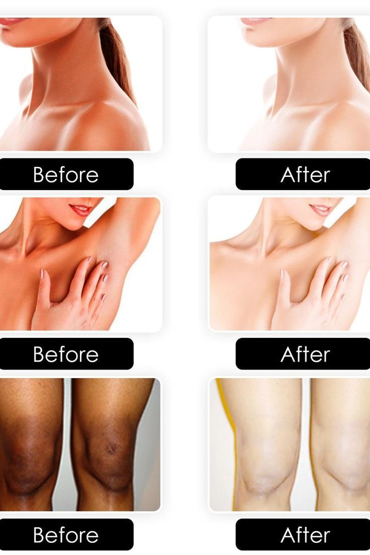 Medicube Kojic Acid Turmeric Body Peel Shot [280ml]