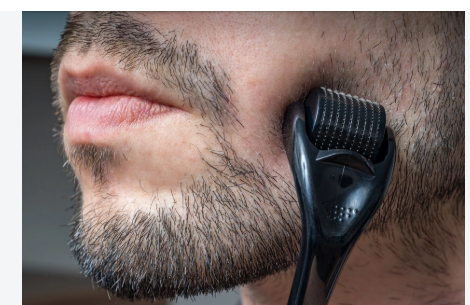 Sevich Derma Roller 0.5mm — Beard & Hair Growth