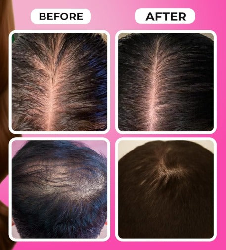 Sevich Fenugreek Batana Super 5X Anti-Hair Loss Oil [40ml]