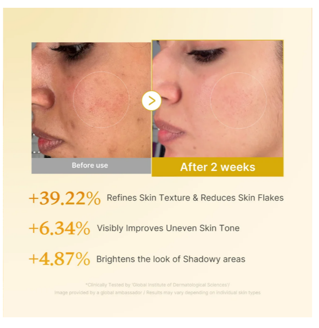 MEDICUBE Kojic Acid Turmeric Resurfacing Toner [250ml]